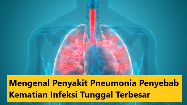 Mengenal Penyakit Pneumonia Penyebab Kematian Infeksi Tunggal Terbesar
