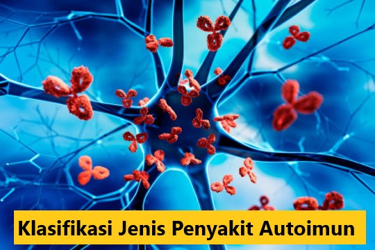 Klasifikasi Jenis Penyakit Autoimun